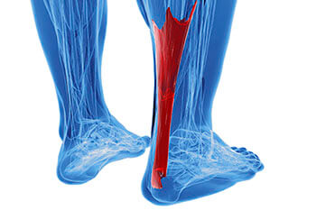 Achilles tendon treatment in the Palm Beach County, FL: West Palm Beach (Royal Palm Beach, Loxahatchee, Riviera Beach, Boca Del Mar, Belle Glade)